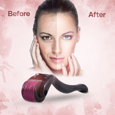 Derma Roller 0.5 Mm Hair & Skin System